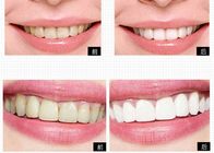 Sistema privato di candeggio del dente dei prodotti di cura personale di logo per i denti domestici che imbiancano